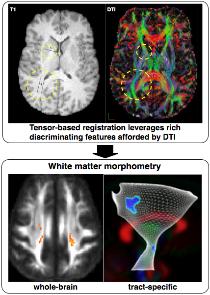 White matter morphometry with DTI-TK