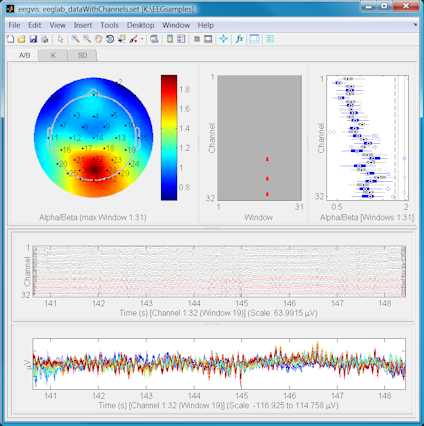 EEGVis is a matlab toolbox for visualizing EEG
