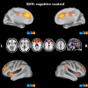 RSN asscociated with cognitive control given by BASH-rs-pICA