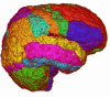 Tetrahedral Mesh of Brain Structures