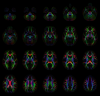 Diffusion anisotropy color maps generated from mean tensors