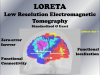 LORETA with Connectivity Tools