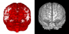 Meta-missingness (red) and significant findings (gray).