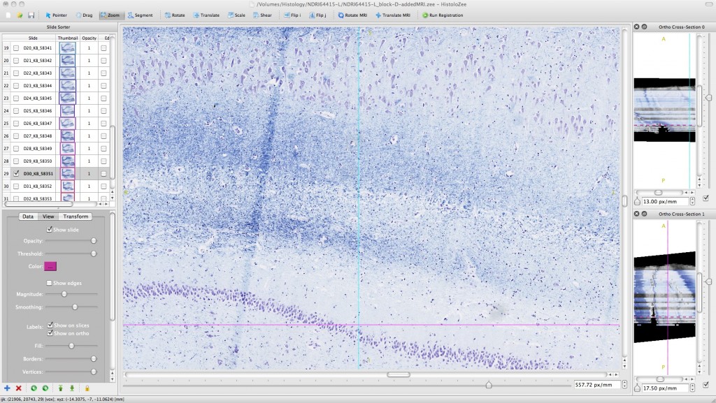 Screenshot: zoomed in histology