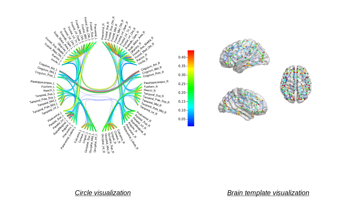 Plot of the brain connectome