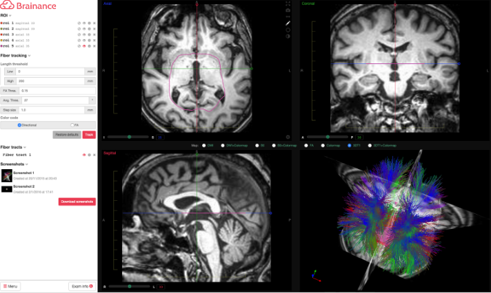 Brainance DTI Module