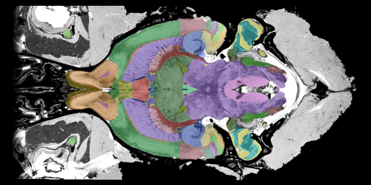 T2*-weighted MRI template with atlas labels