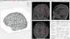 Grid electrodes localization