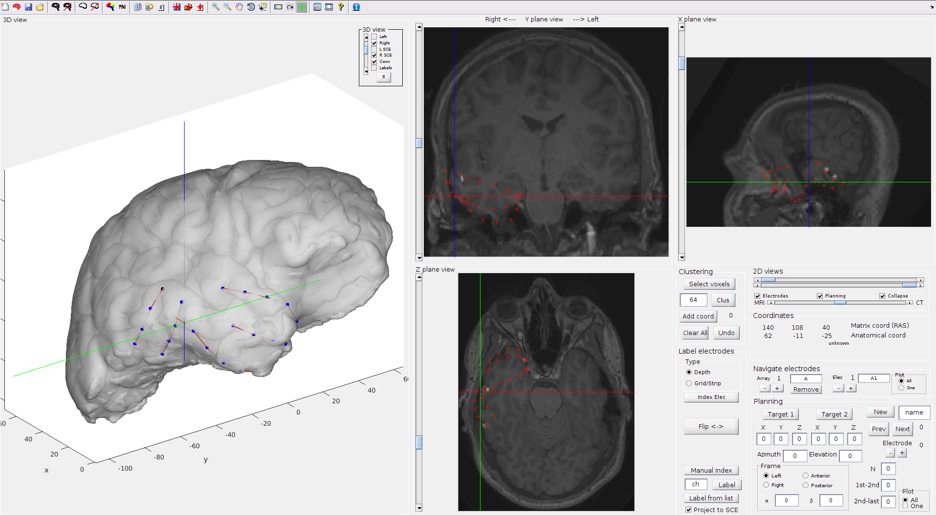Projection of electrodes to cortical surface (convex hull)