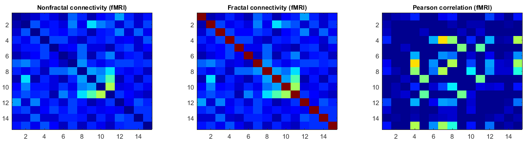 Fractal and nonfractal connectivity