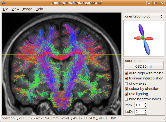 MRView, the MRtrix OpenGL-based viewer