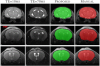 Mice images with TBI