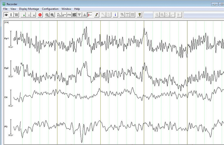 BrainVision Recorder