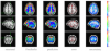 Automated Parcellation.