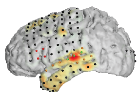 NeuralAct: A tool to visualize cortical activity on a 3D mod