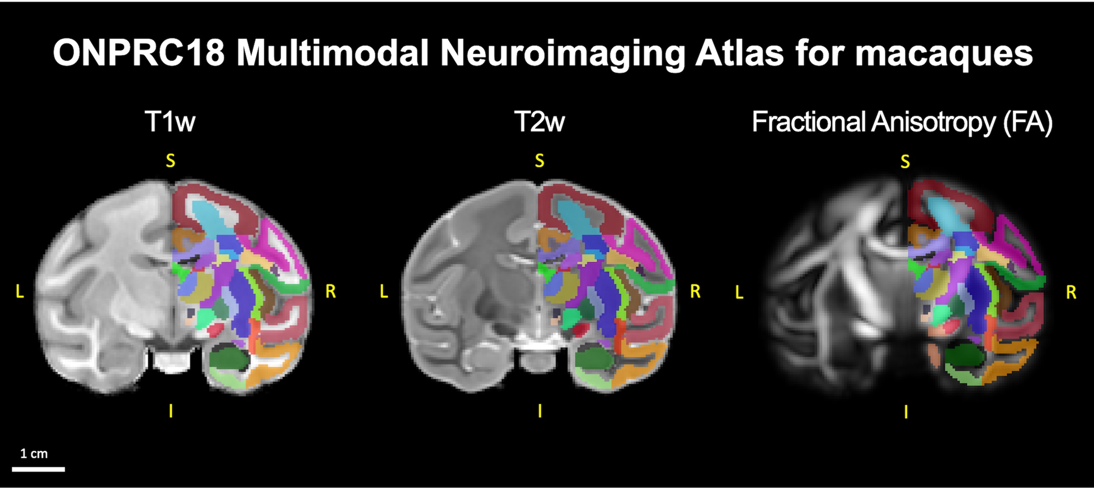 ONPRC18 multimodal MRI atlas for macaques 