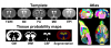 HRT: A SHR brain template set