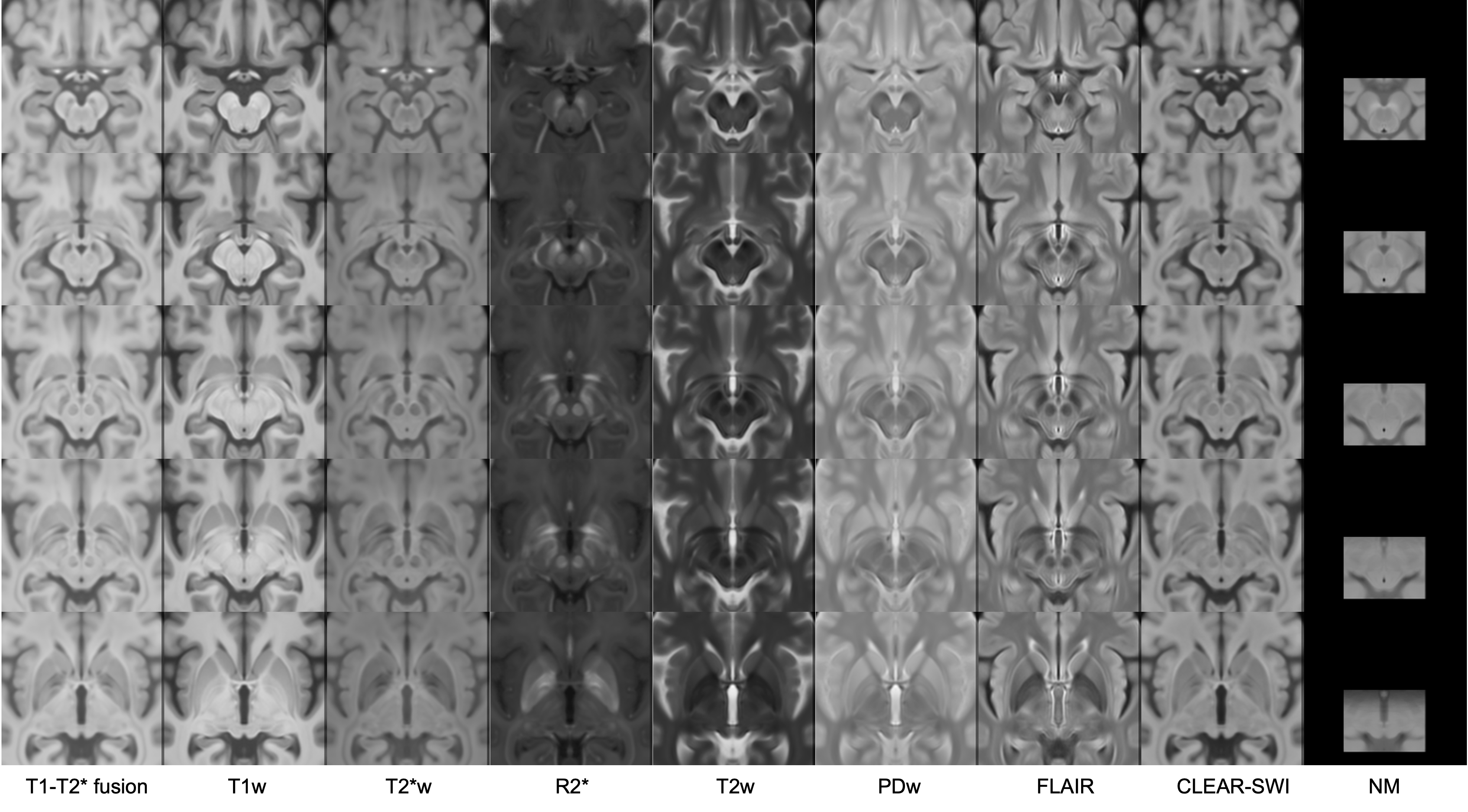 0.3mm Isotropic Parkinson's Template in Nine Contrasts