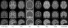 1mm Isotropic Healthy Controls Template in Eight Contrasts
