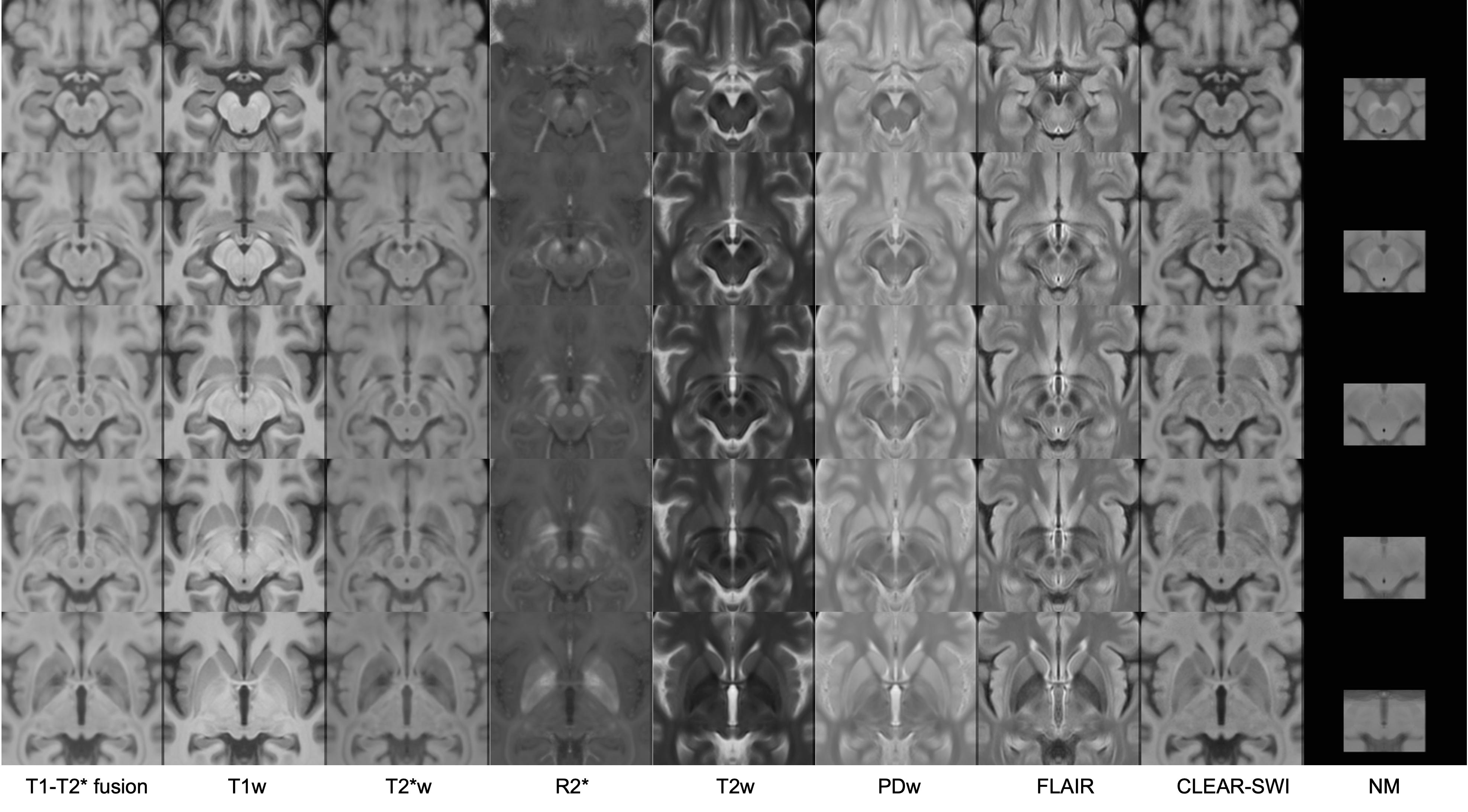 0.3mm Isotropic Healthy Controls Template in Nine Contrasts