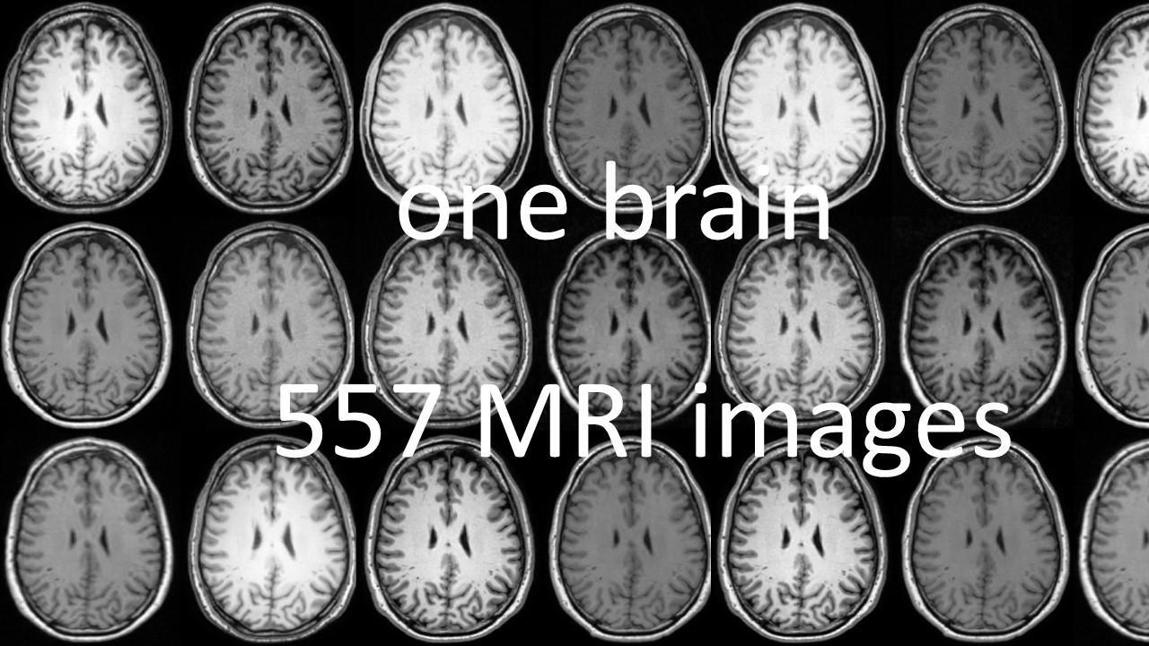 one brain- 557 MRI images