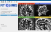RT-OSIRIS Screenshot