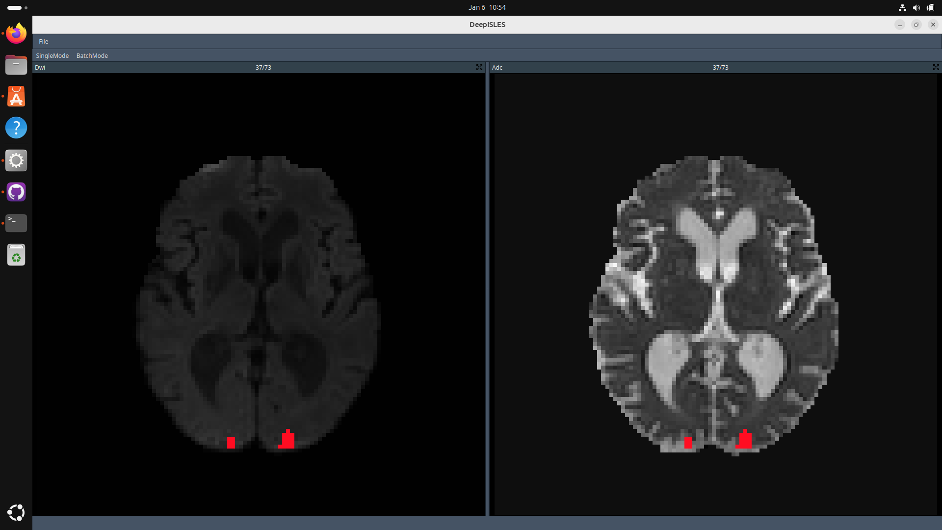 DeepISLES screenshot.