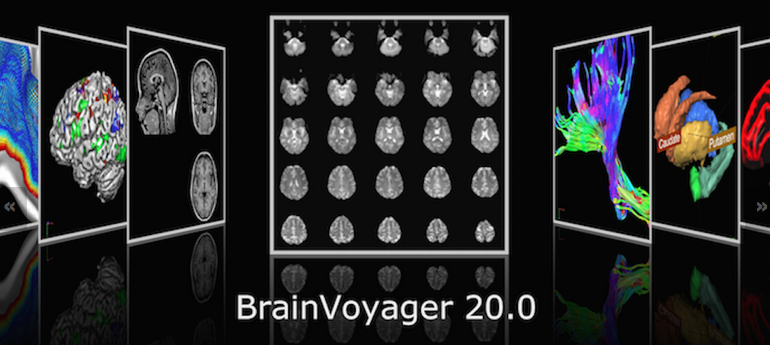 BrainVoyager 20