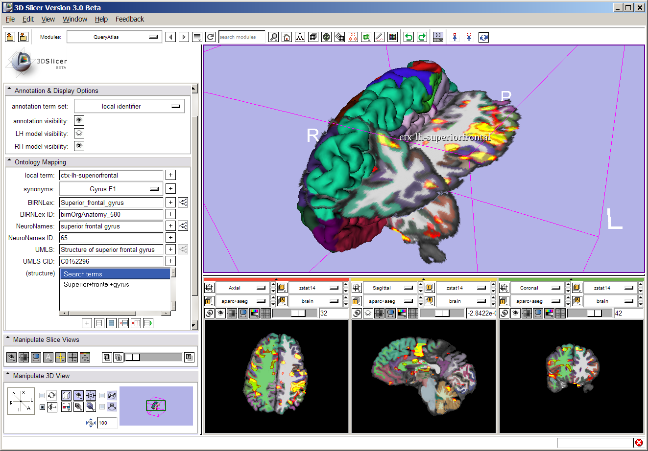 Visualizing combined morphology and functional analyses