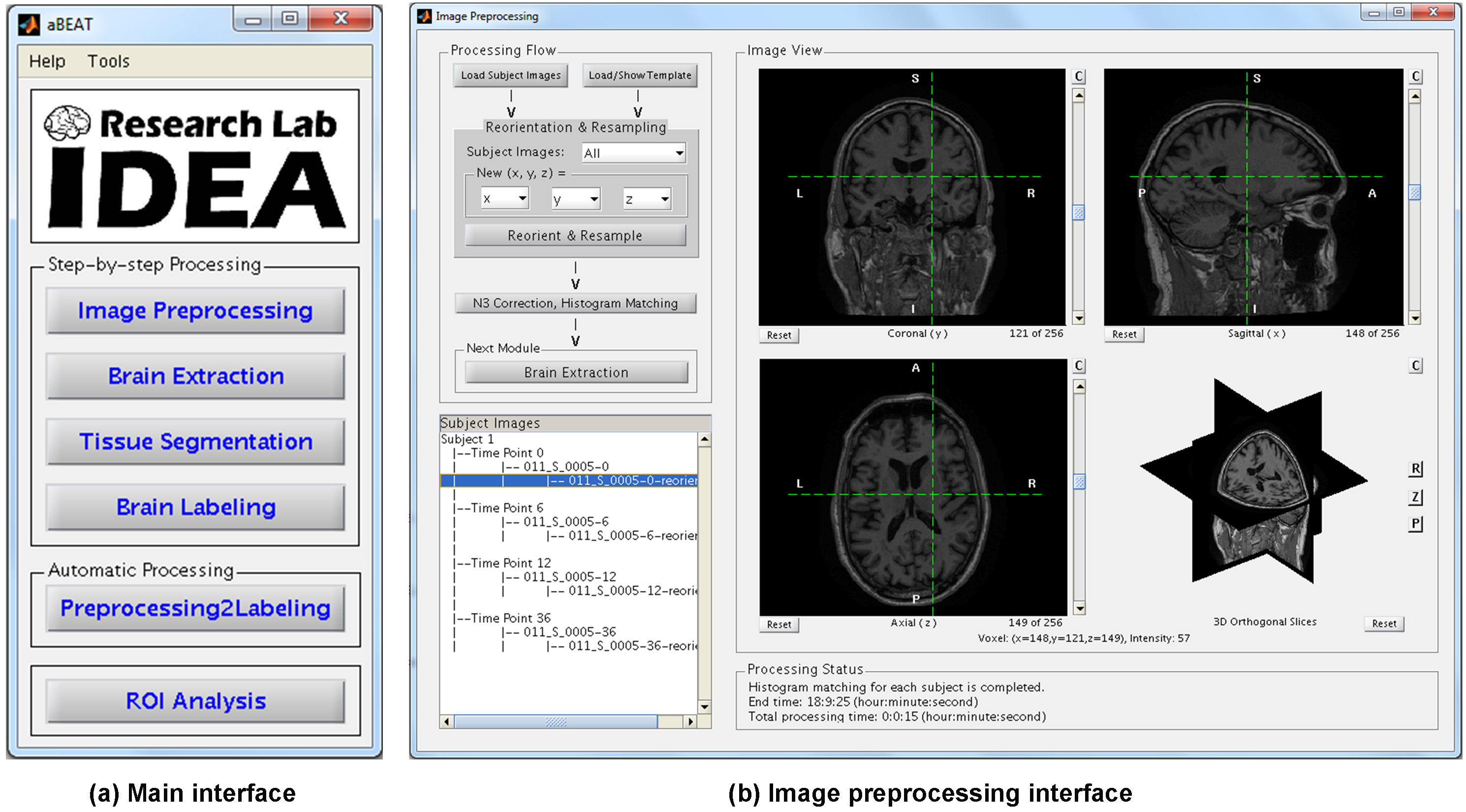 The main interface and image preprocessing interface in aBEA