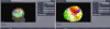 MEG and EEG sensors