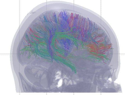 Tractography