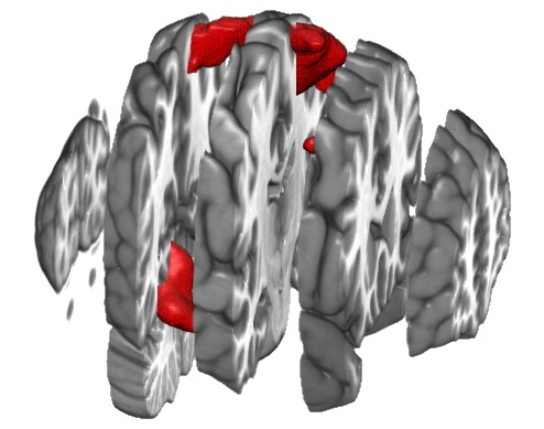 MRIcroGL exploded brain rendering
