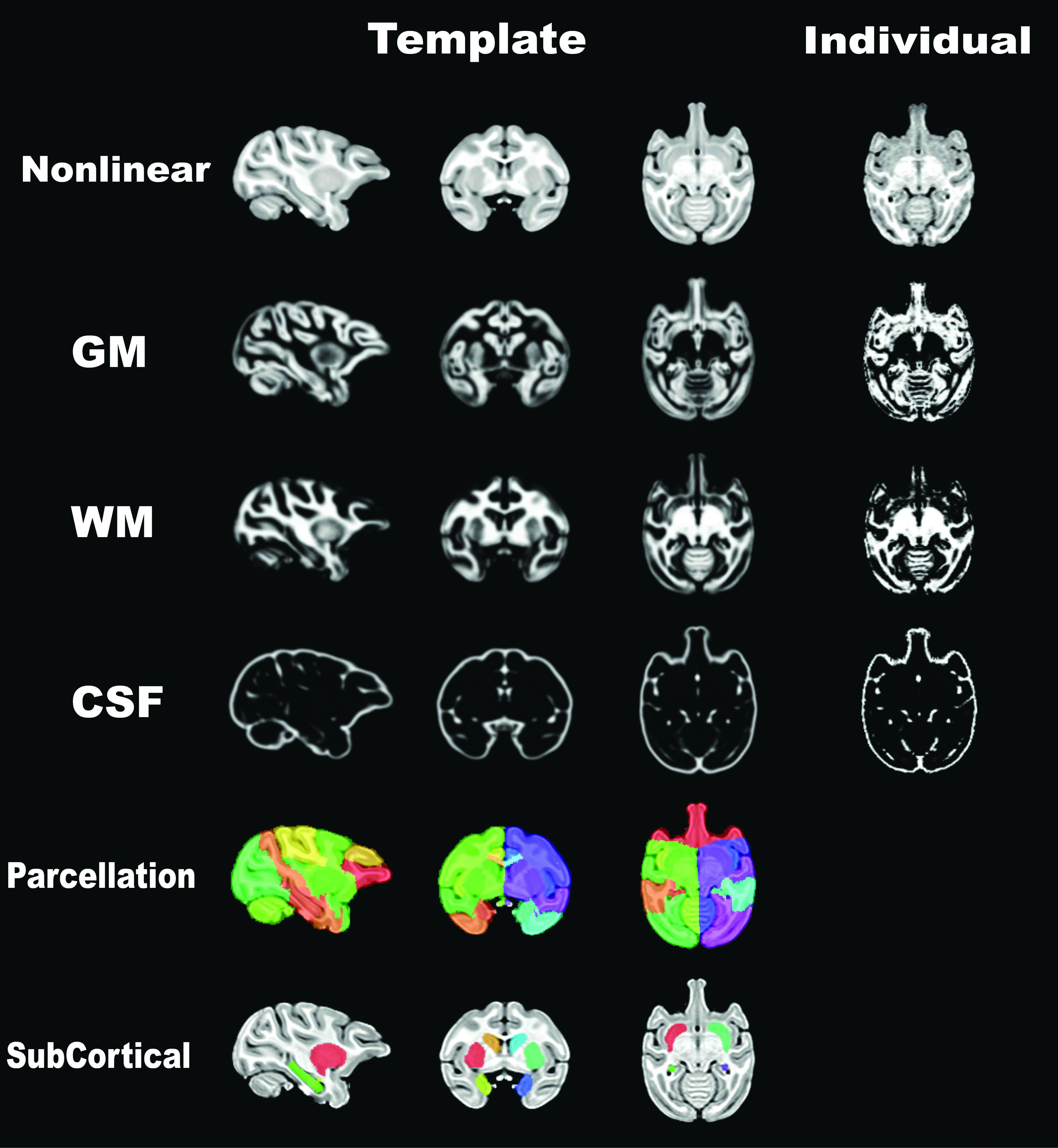 MRI (T1-w) template  (by ANTS)