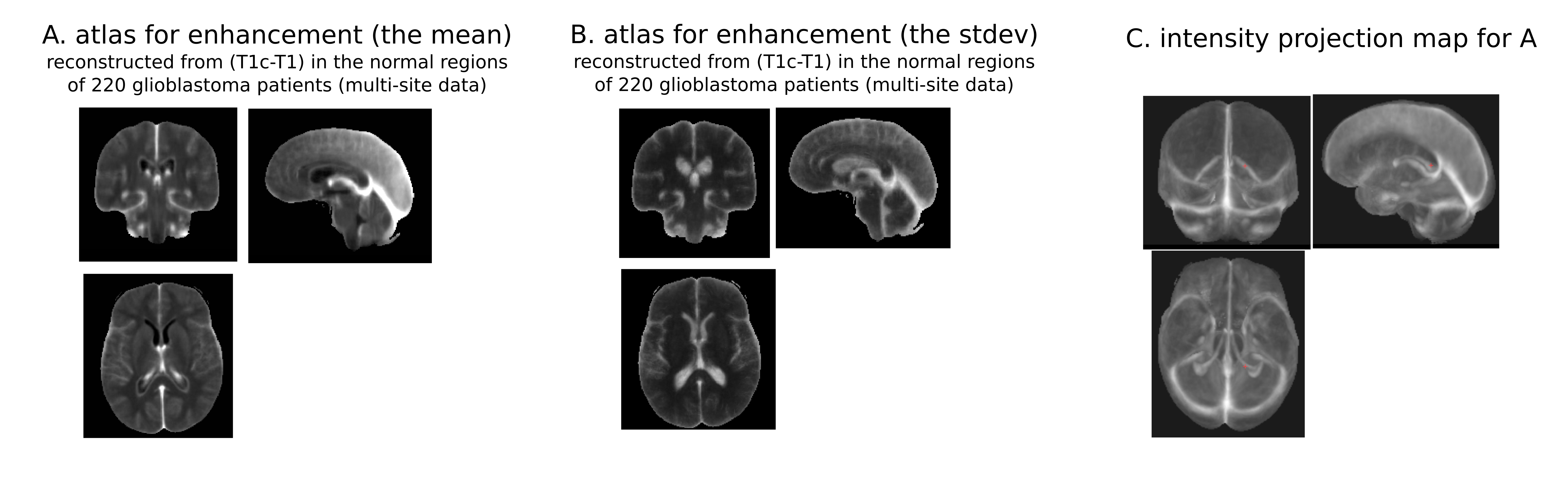 T1c atlases in 3D