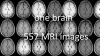 one brain- 557 MRI images