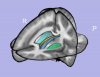 Brain atlas